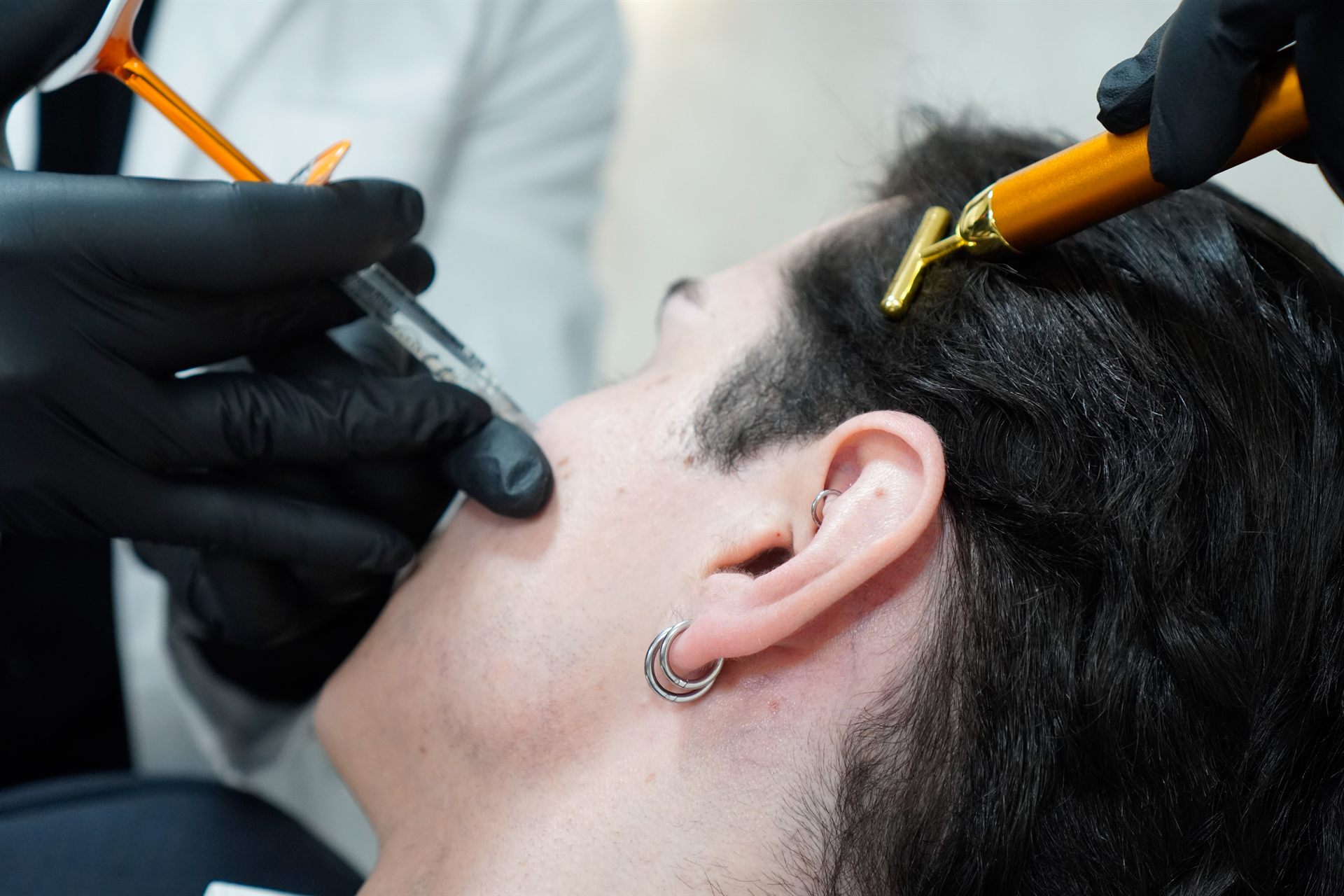 Ácido hialurónico facial