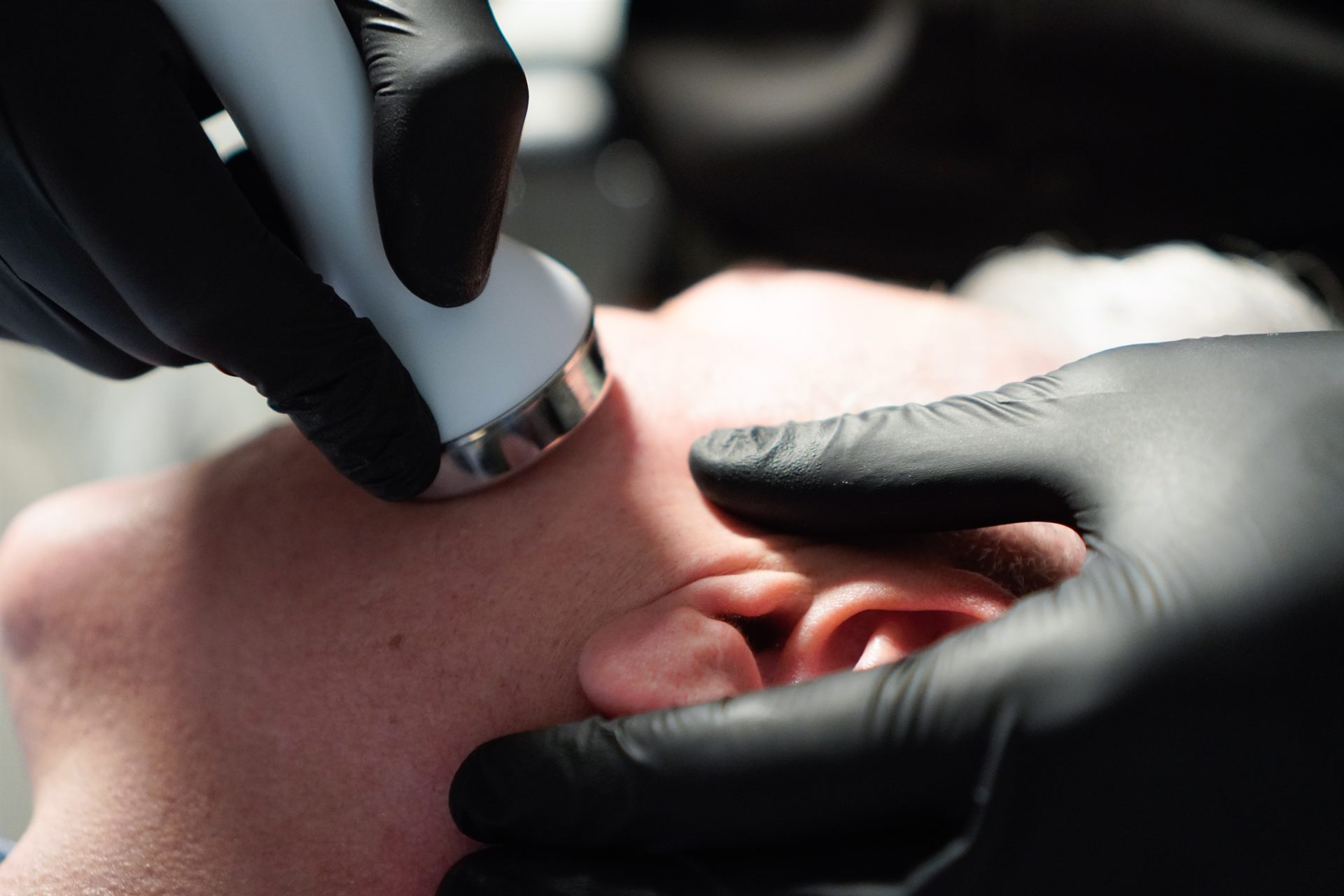 Láser, IPL, radiofrecuencia e HIFU